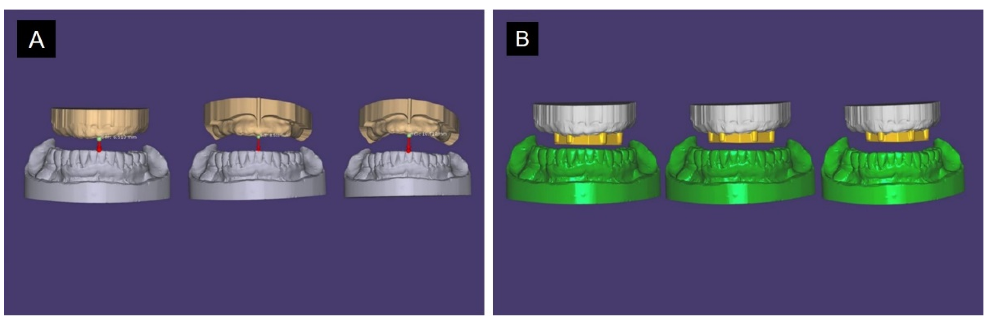 Applsci 11 03933 g005