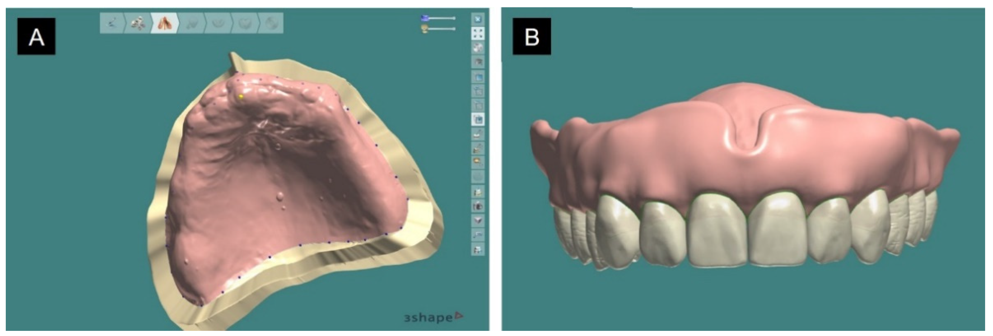 Applsci 11 03933 g006