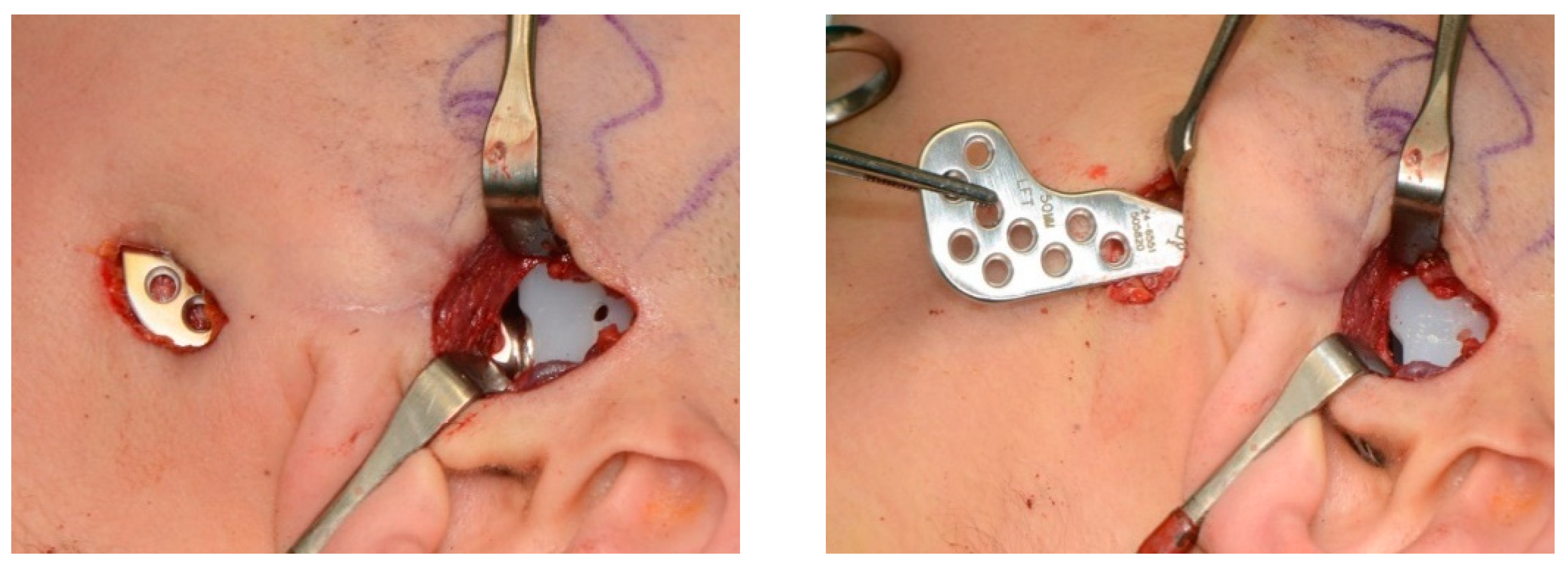 Applsci 11 03935 g001 Applsci 11 03935 g001