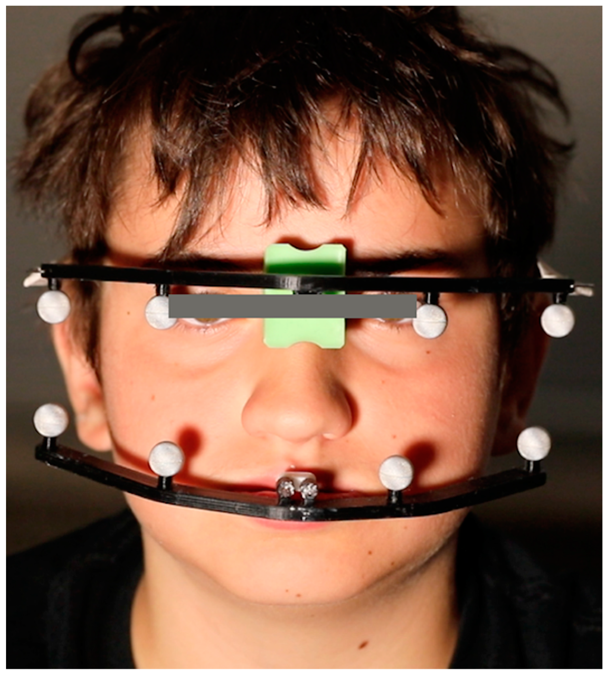 Applsci 11 03947 g002