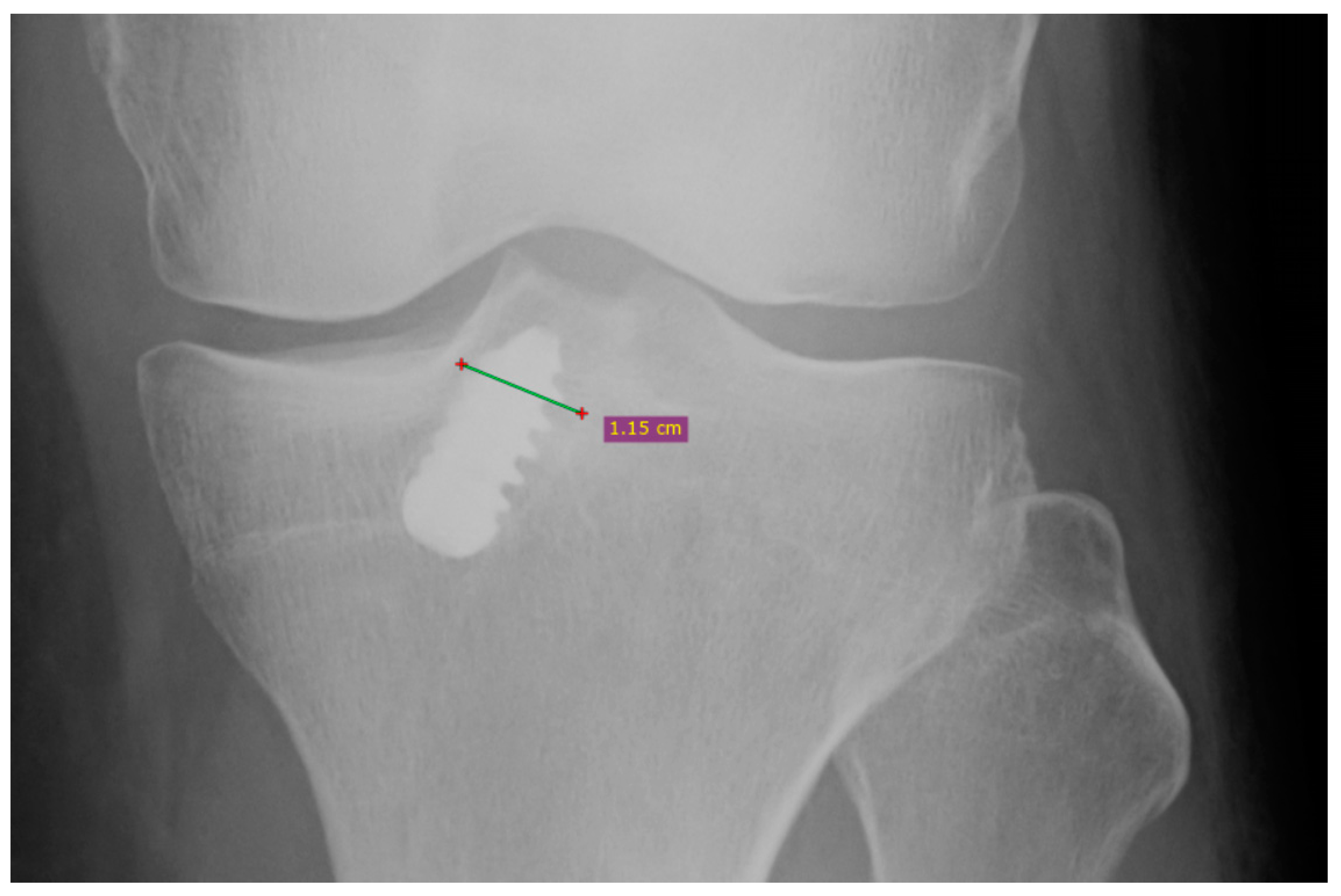 Applsci 11 03993 g004