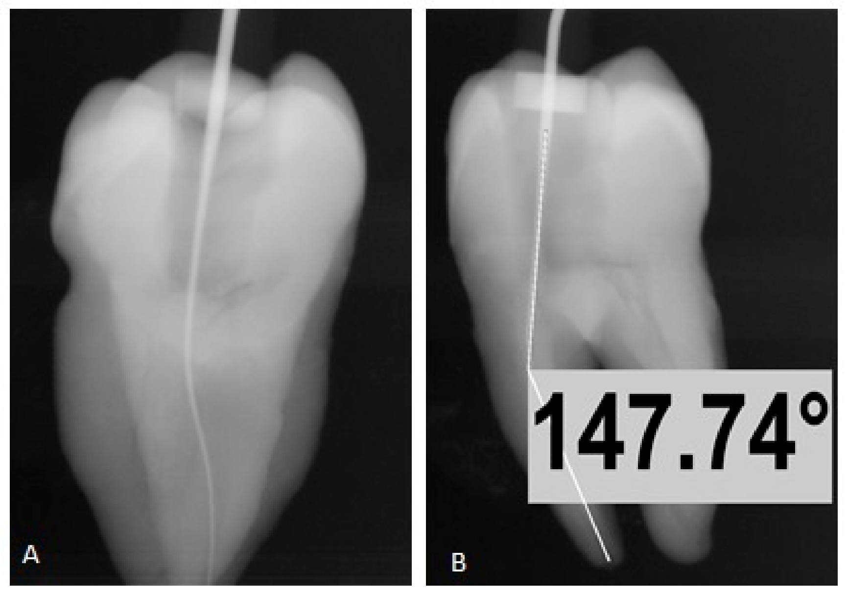 Applied Sciences Free FullText Plywood Jig—A New Technique for Root Canal Curvature Measurement