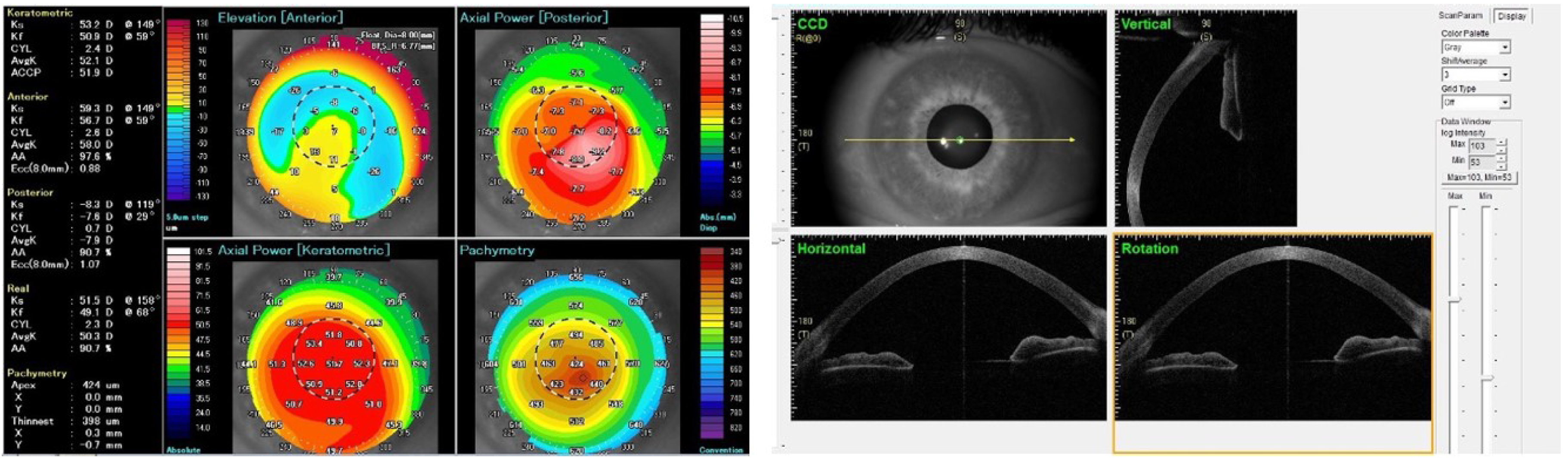 Applied Sciences Free FullText Comparison of AmslerKrumeich and