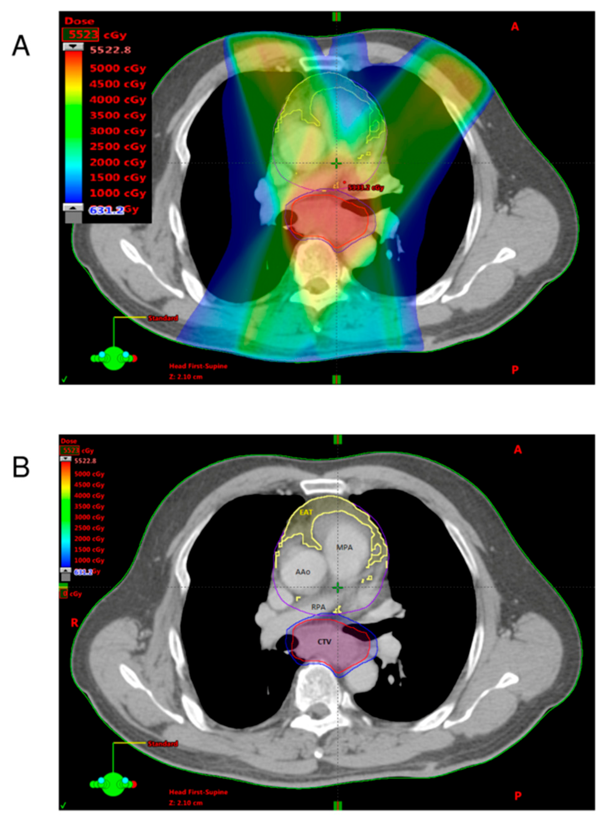 Applsci 11 04023 g001