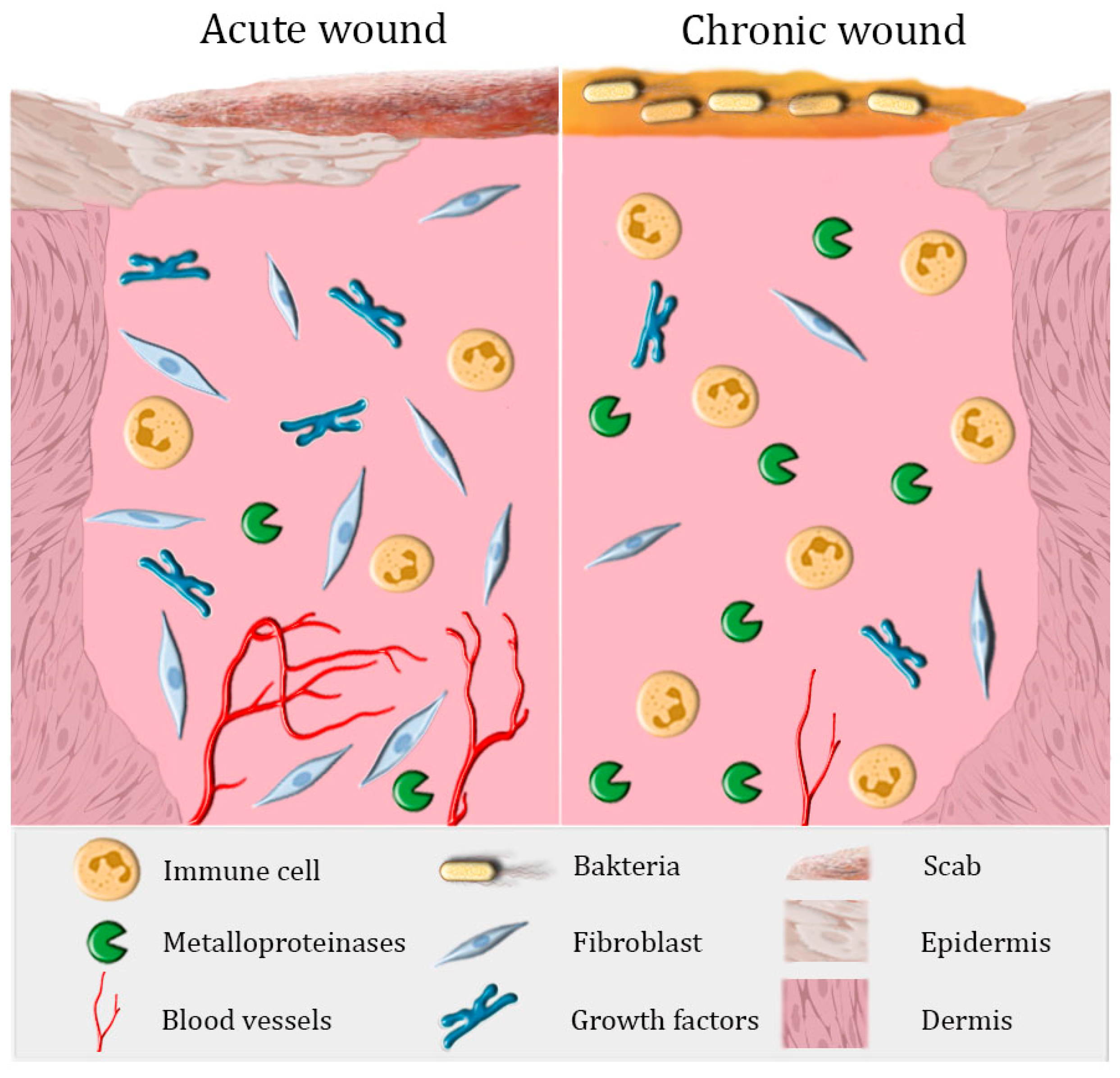 Smart wound dressing for advanced wound management: Real-time monitoring  and on-demand treatment - ScienceDirect