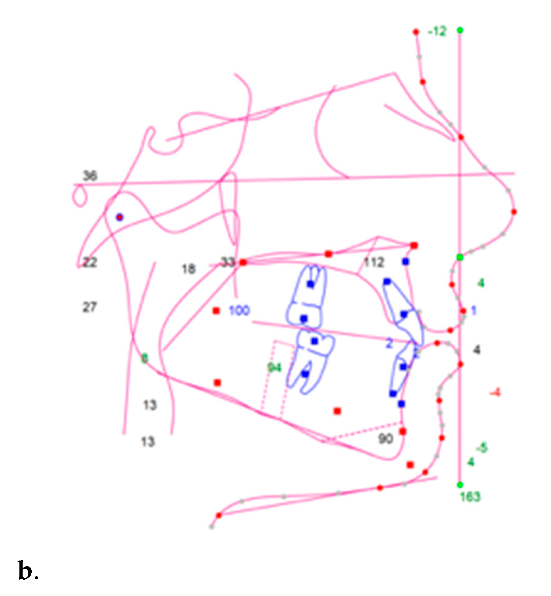 Applsci 11 04118 g001b