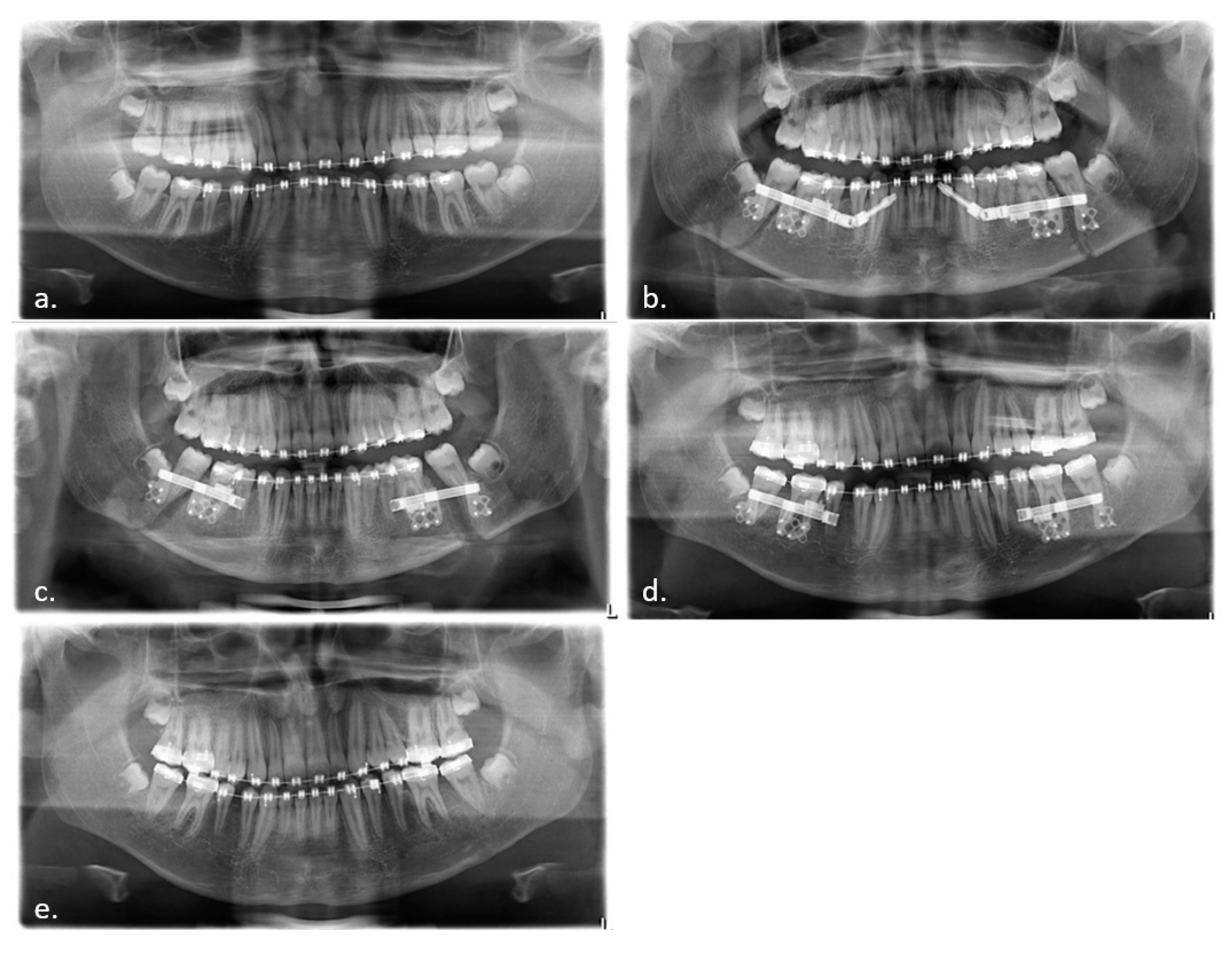 Applsci 11 04118 g003