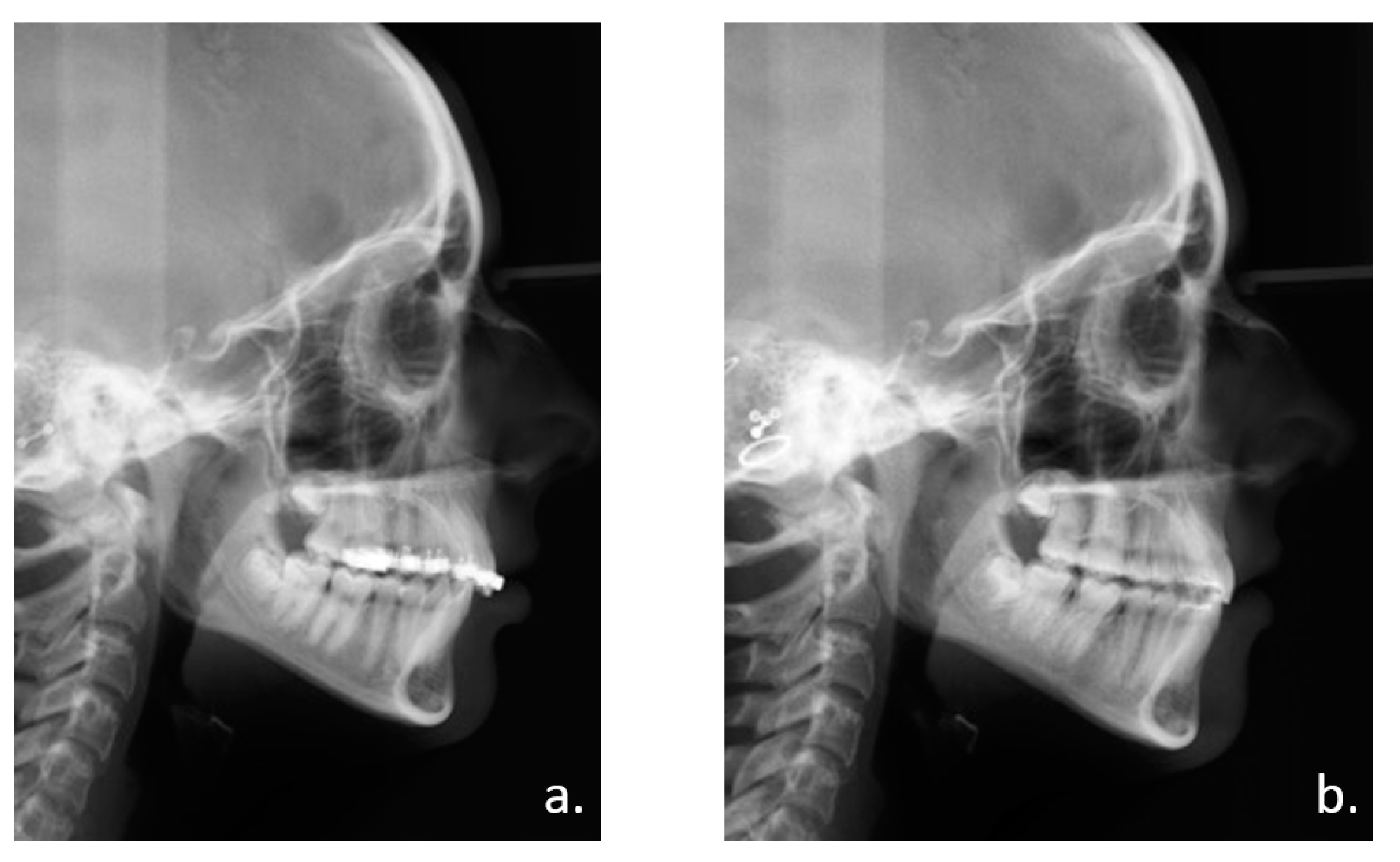 Applsci 11 04118 g004