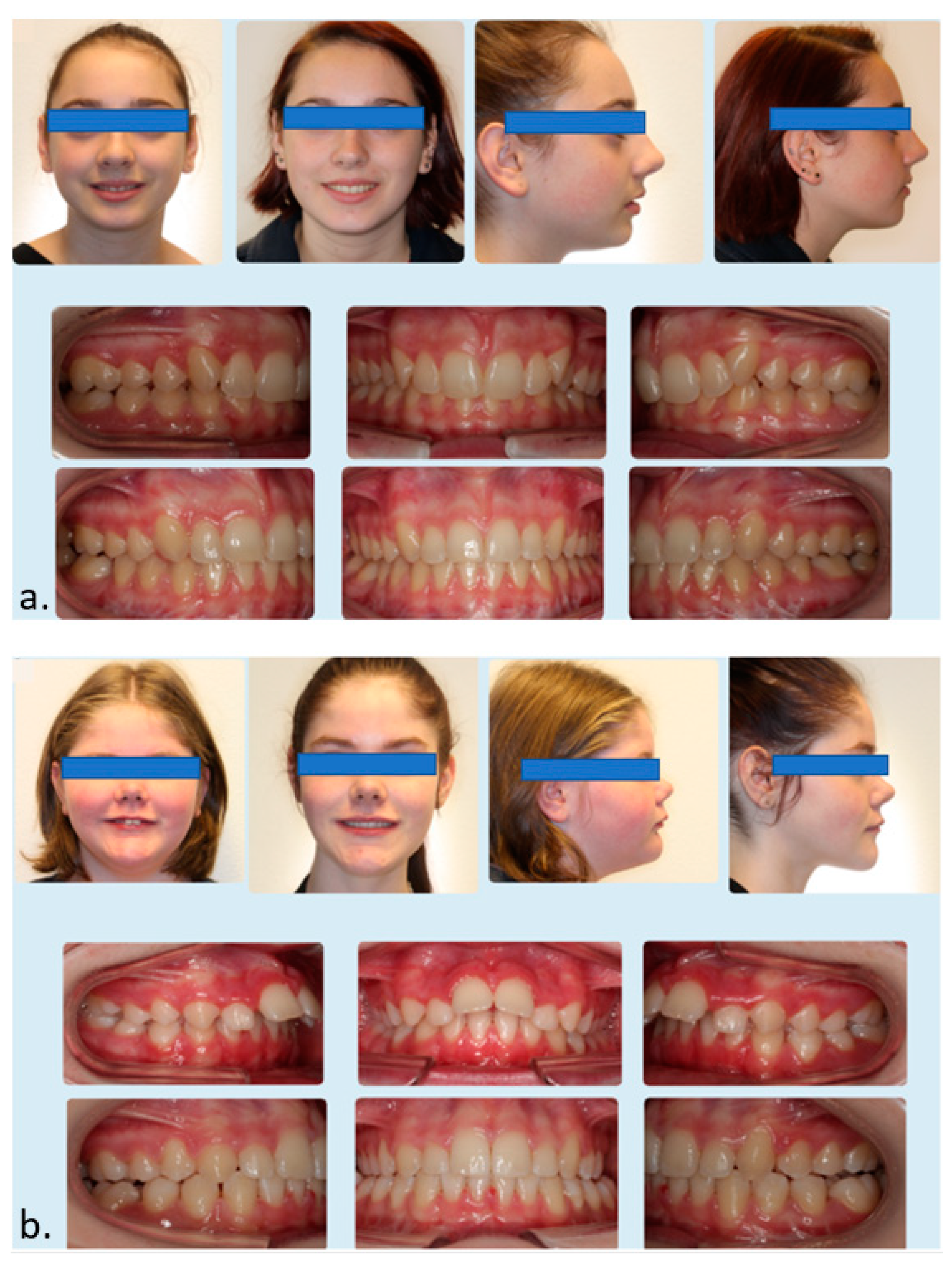 Applsci 11 04118 g005