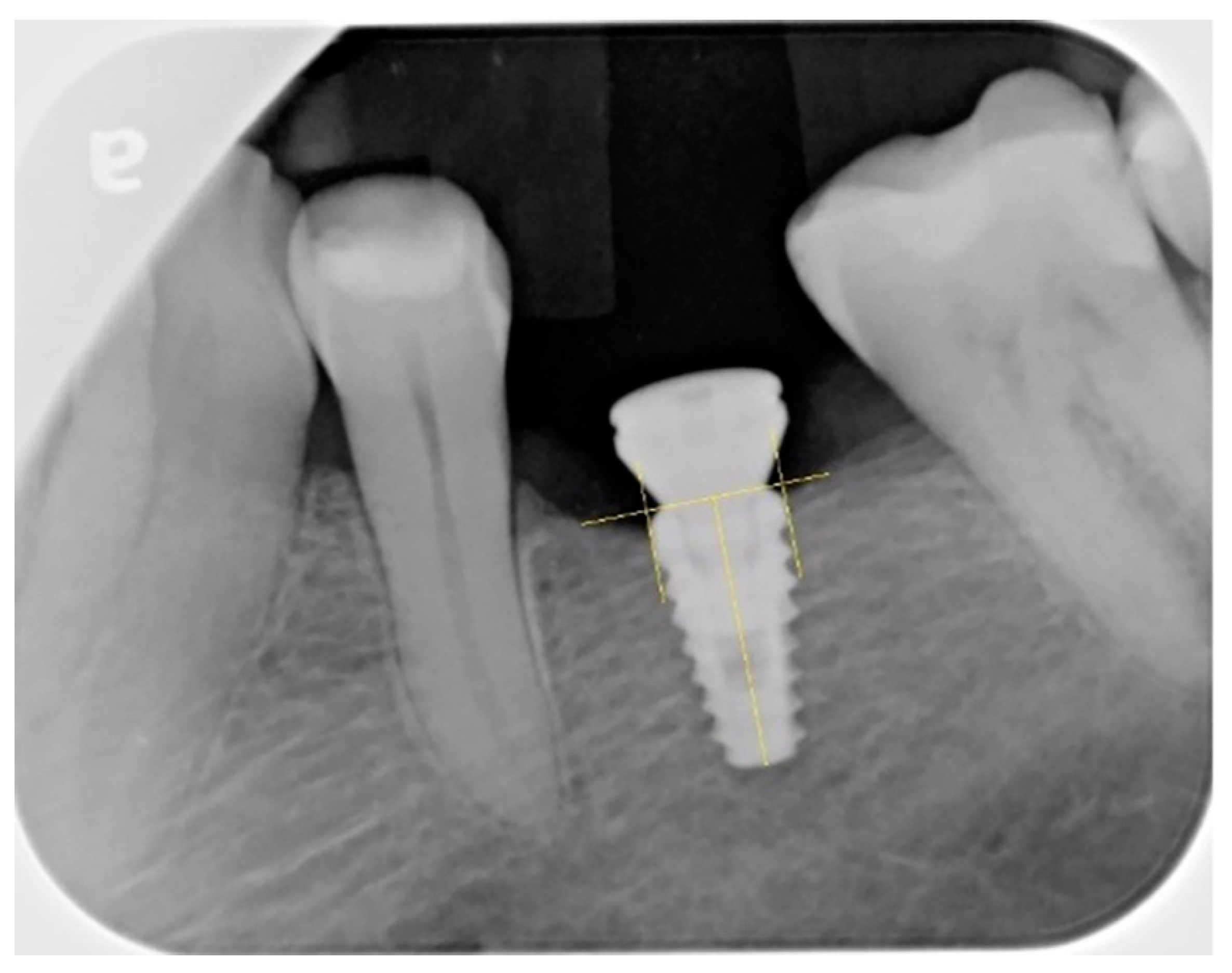 Applsci 11 04140 g001