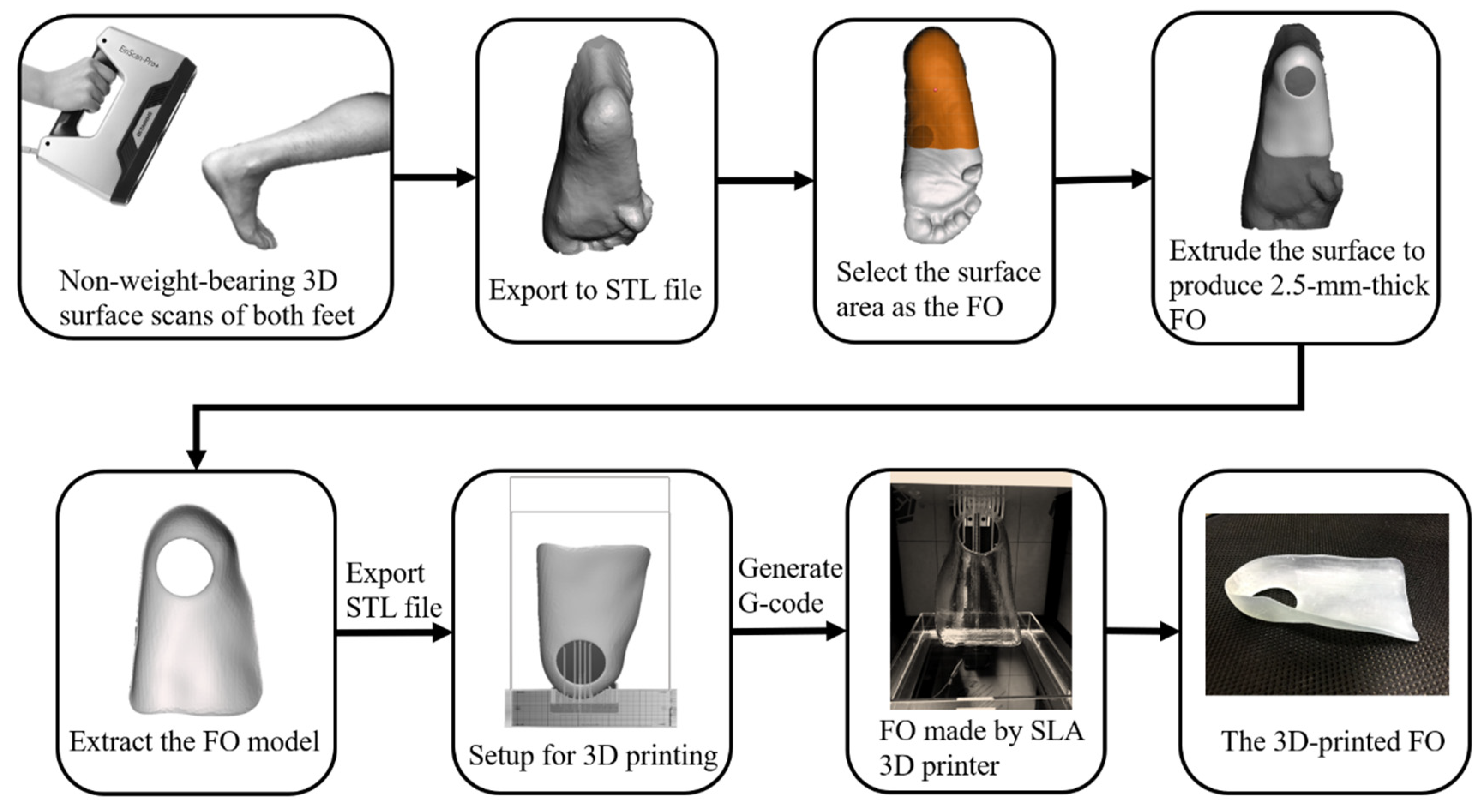 Applied Sciences | Free Full-Text | Biomechanical Effect of 3D-Printed Foot  Orthoses in Patients with Knee Osteoarthritis