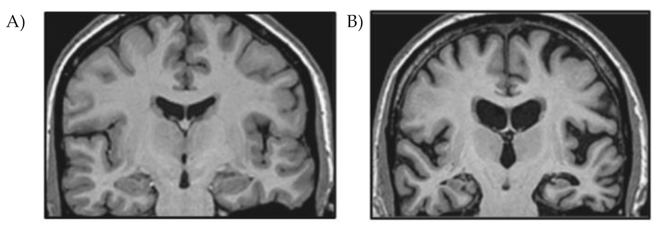 Applsci 11 04305 g002