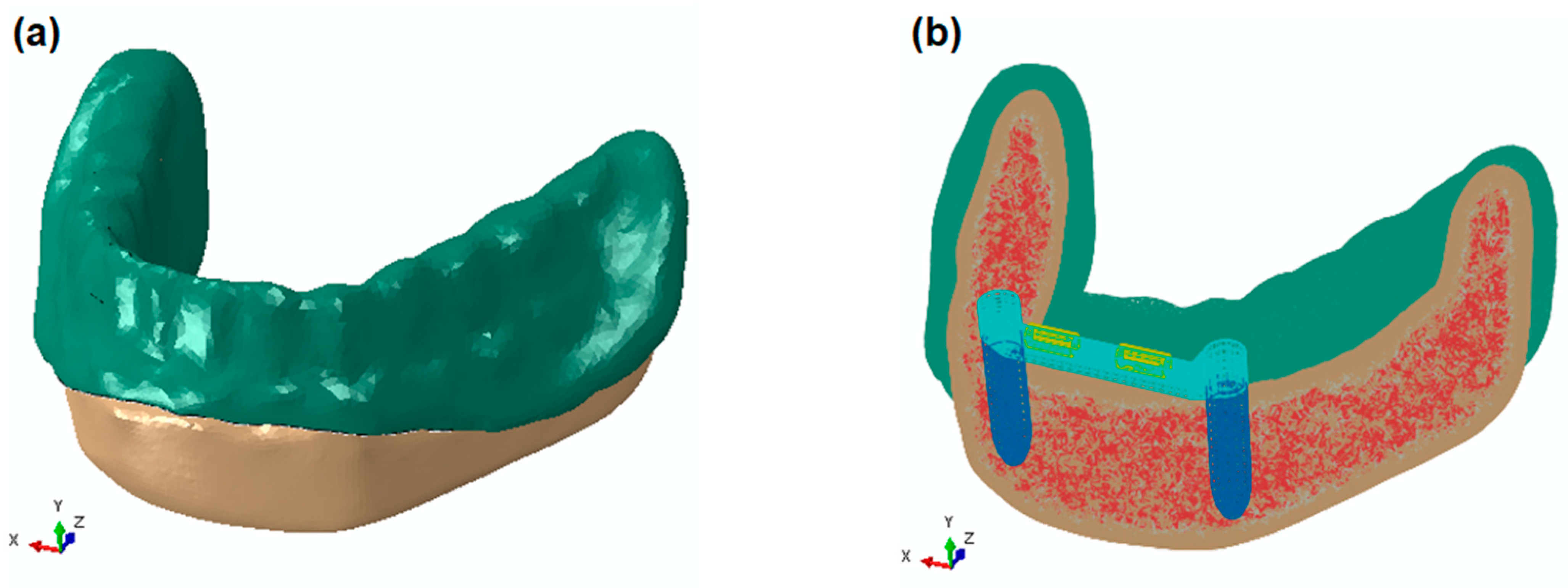 Applsci 11 04339 g002 Applsci 11 04339 g002