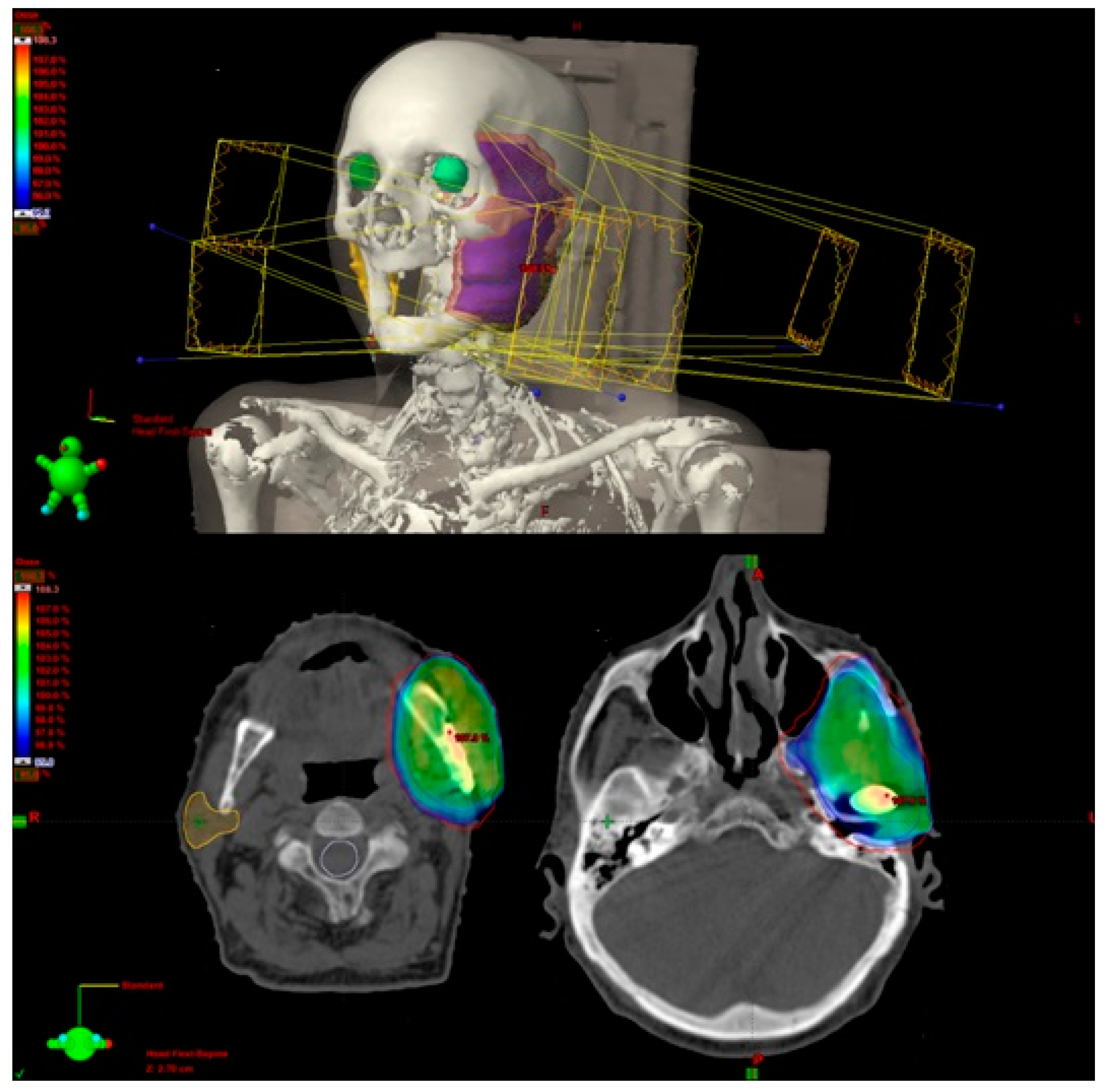 Applsci 11 04373 g007 Applsci 11 04373 g007