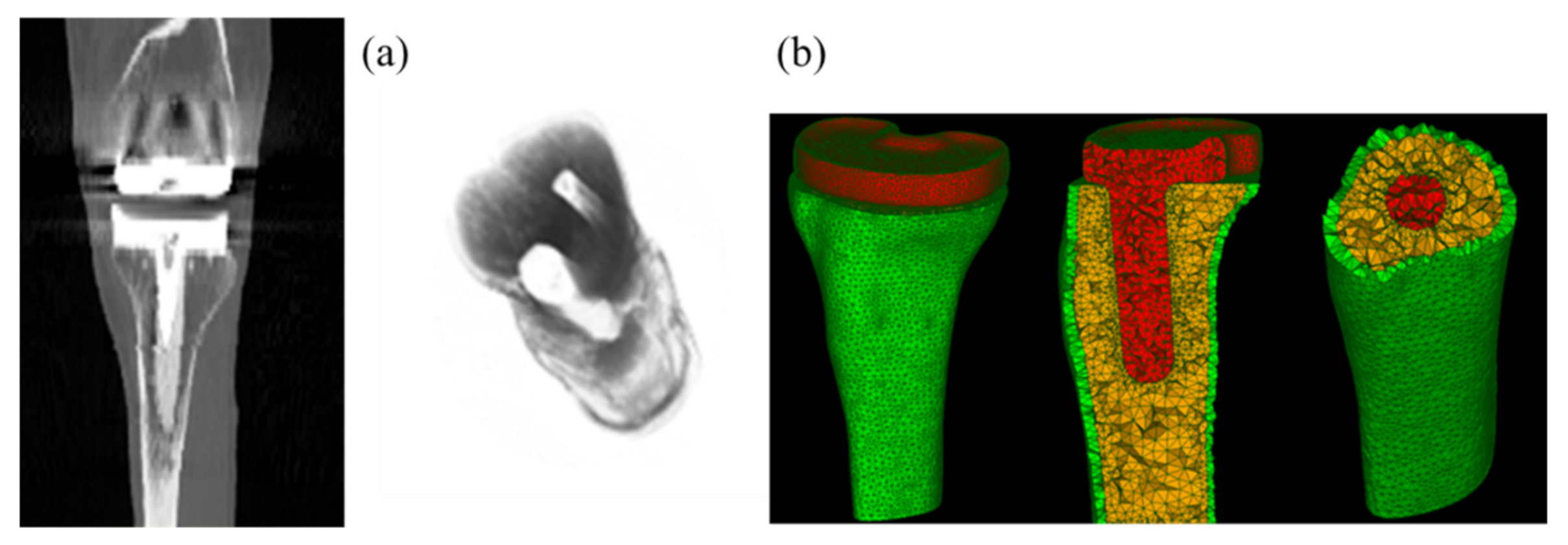 Applsci 11 04435 g002 Applsci 11 04435 g002