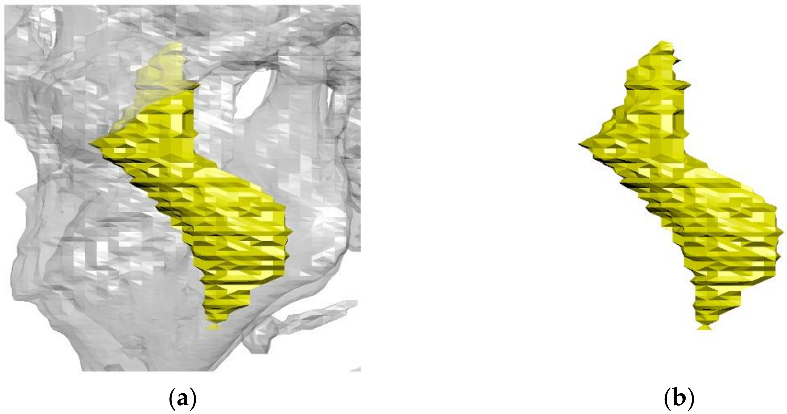 Applsci 11 04444 g001a