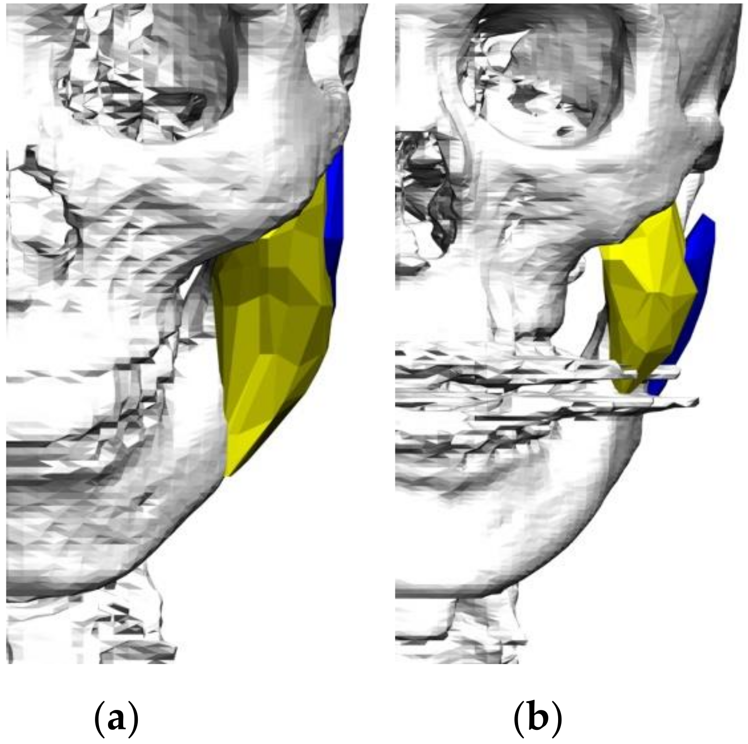 Applsci 11 04444 g002