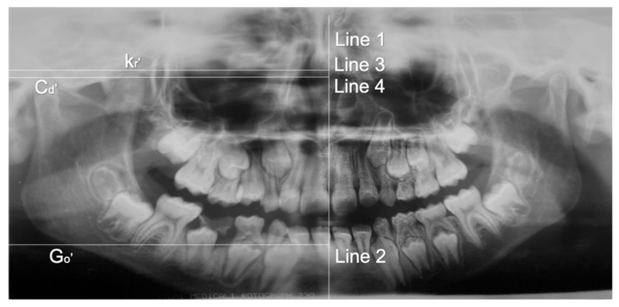 Applsci 11 04504 g002 Applsci 11 04504 g002