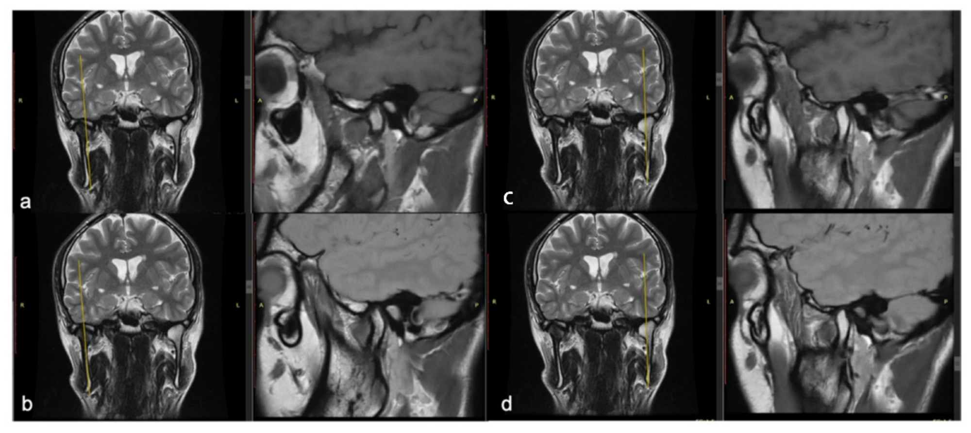 Applsci 11 04504 g010 Applsci 11 04504 g010