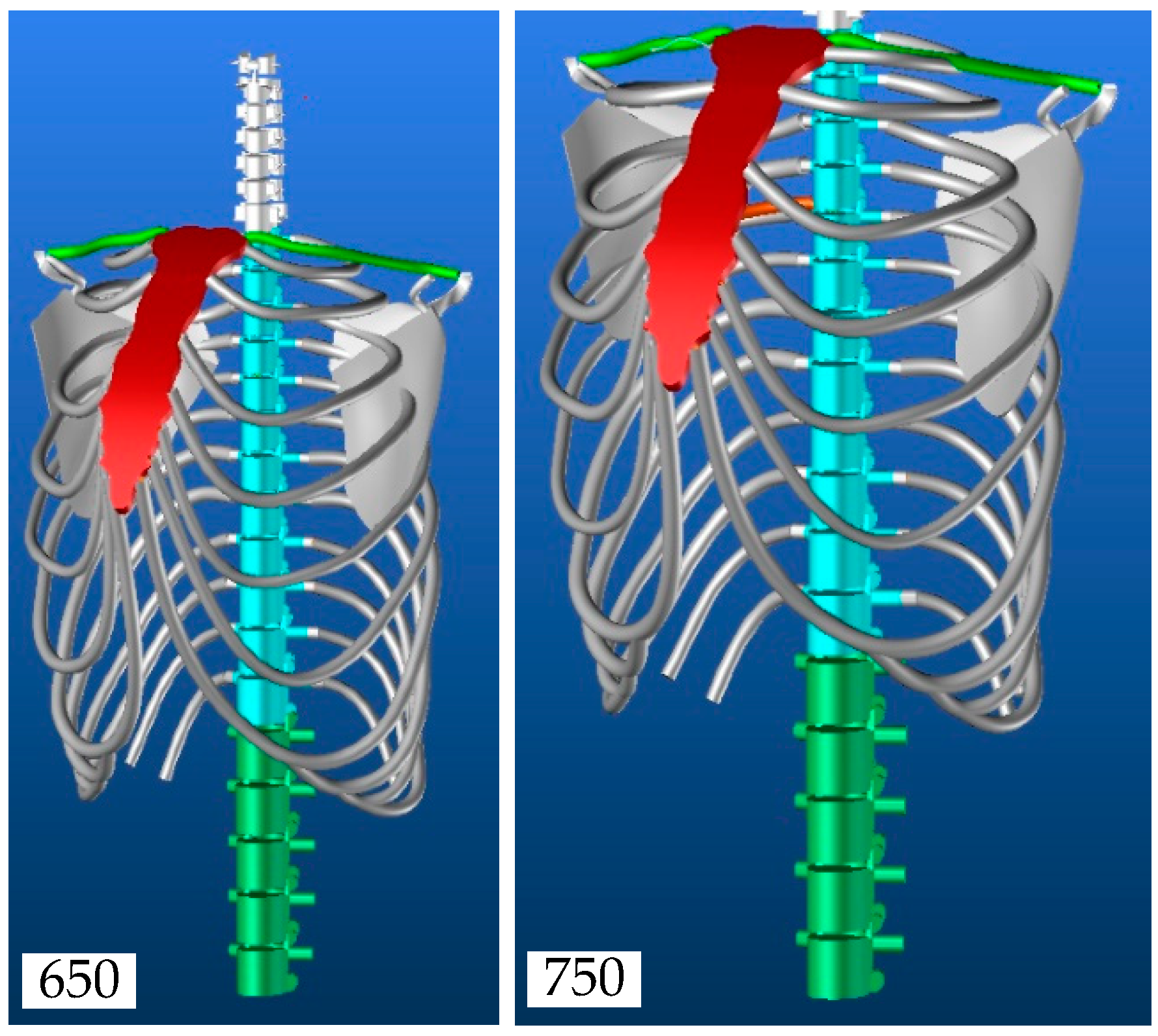 Applsci 11 04545 g015 Applsci 11 04545 g015
