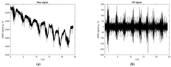 Processing of EMG Signals with High Impact of Power Line and Cardiac ...