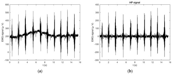 Processing of EMG Signals with High Impact of Power Line and Cardiac ...