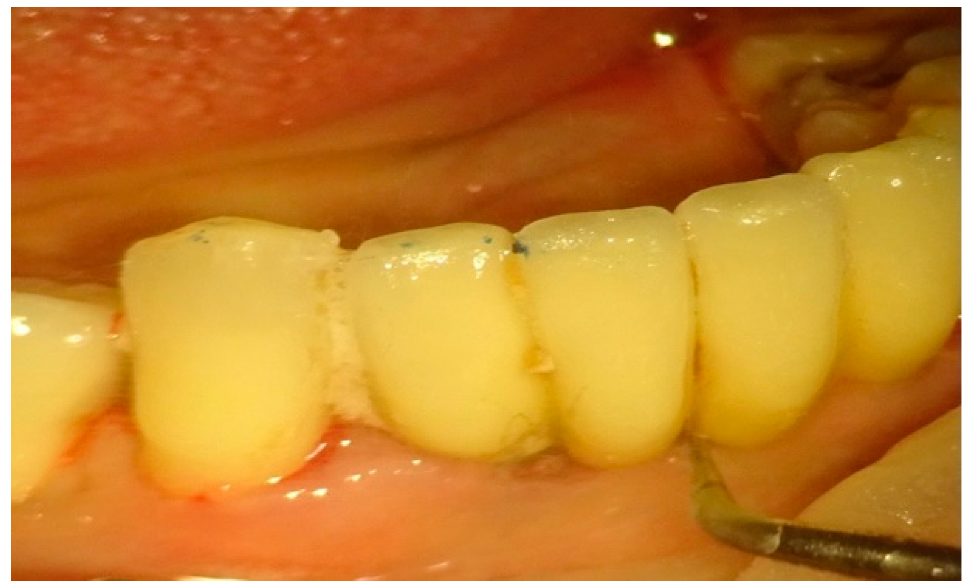 Applsci 11 04629 g001