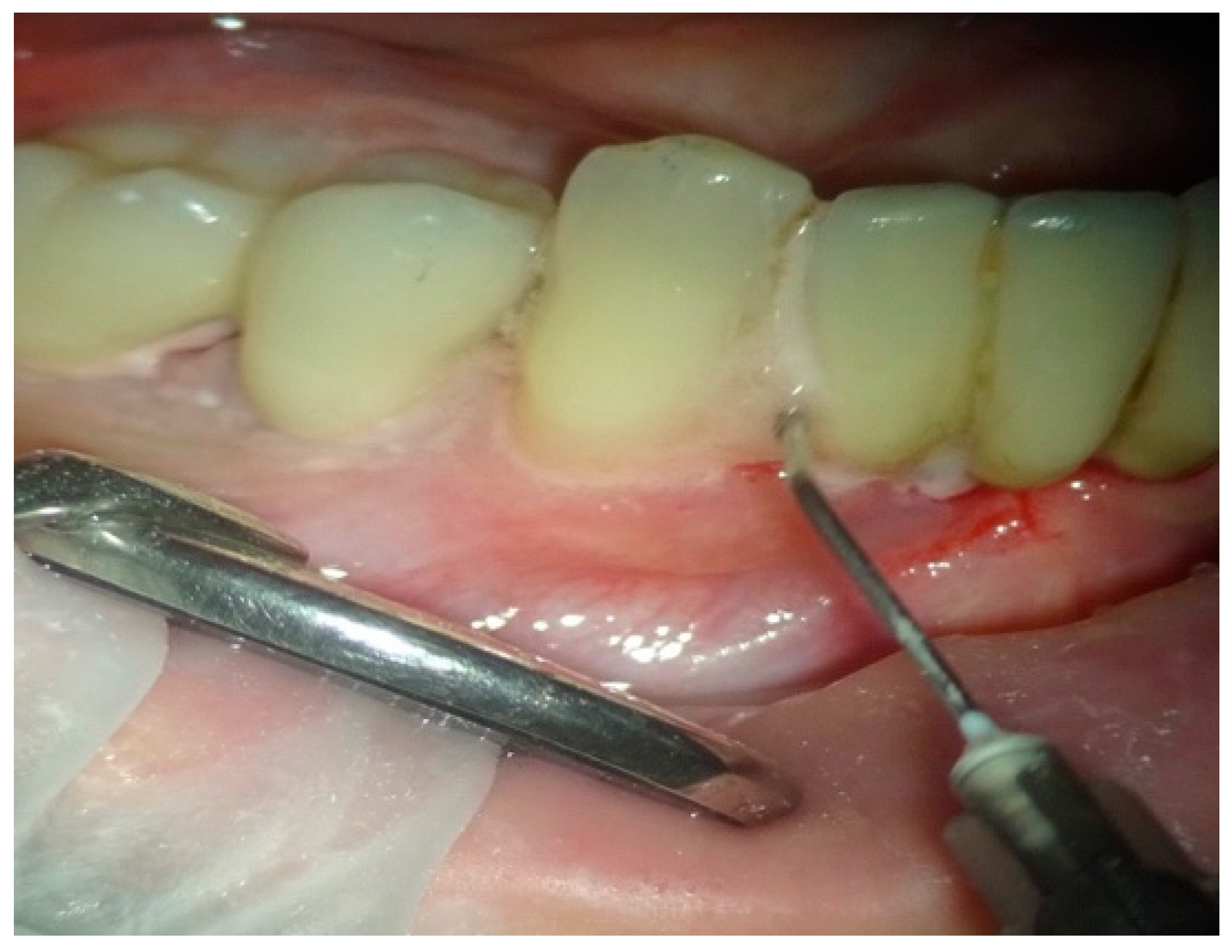 Applsci 11 04629 g003