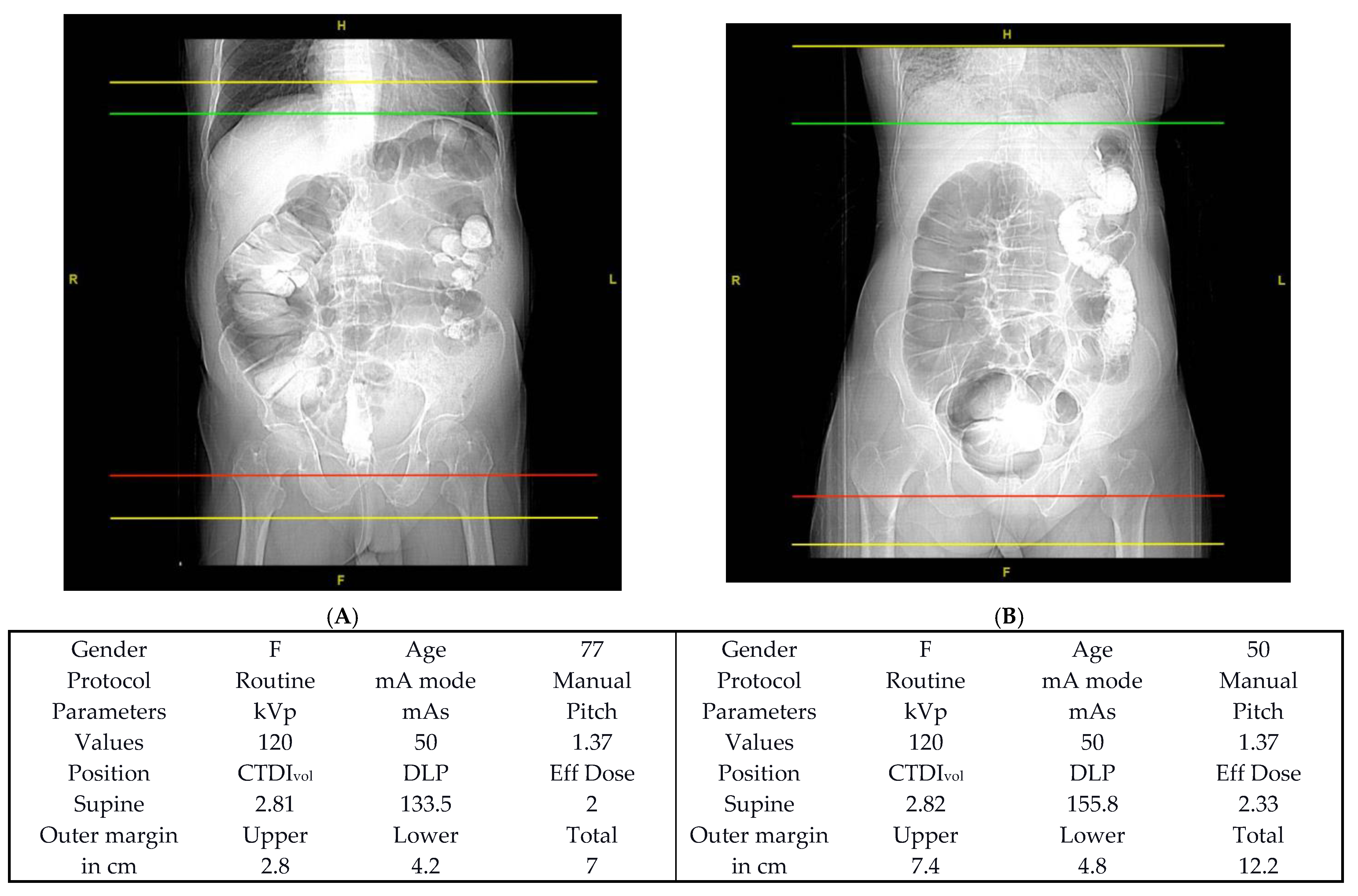 Applsci 11 04761 g003 Applsci 11 04761 g003