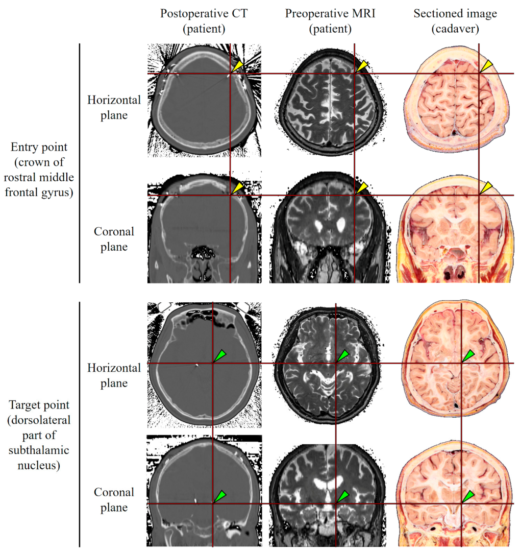 Applsci 11 04999 g001