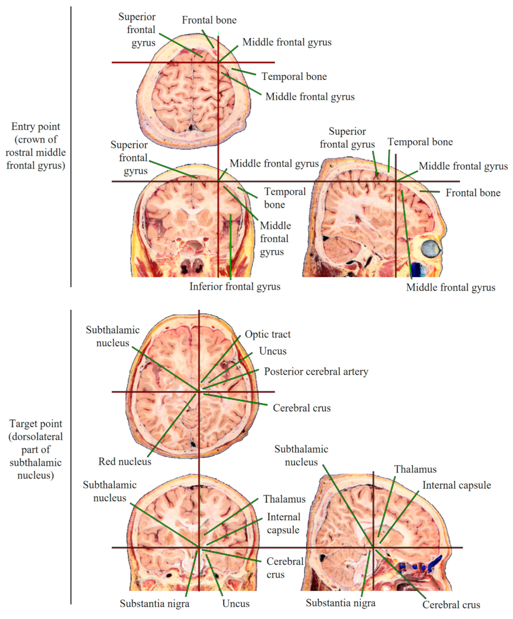 Applsci 11 04999 g003