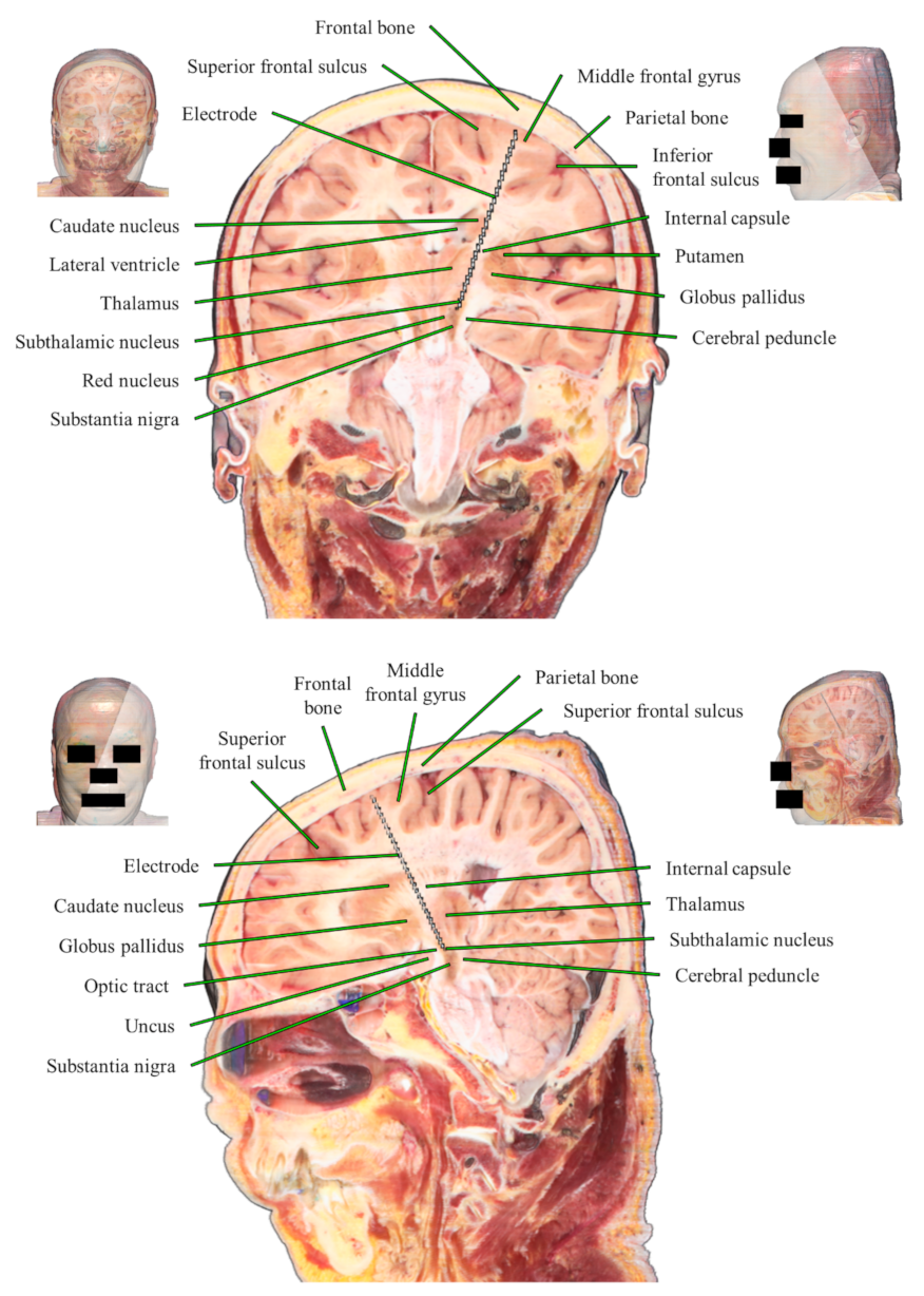 Applsci 11 04999 g005