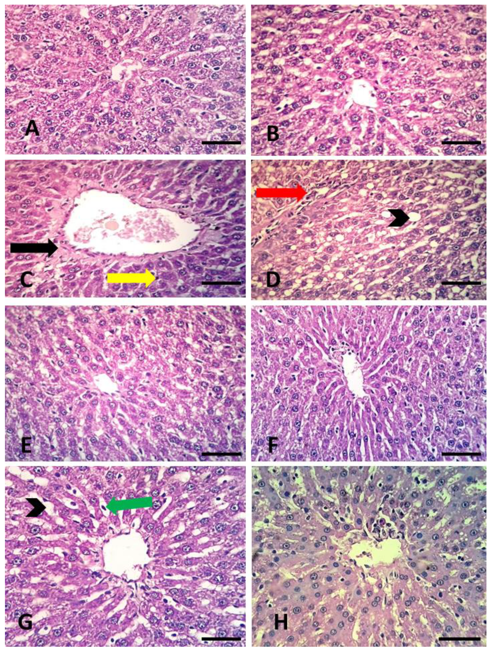 Applsci 11 05059 g003
