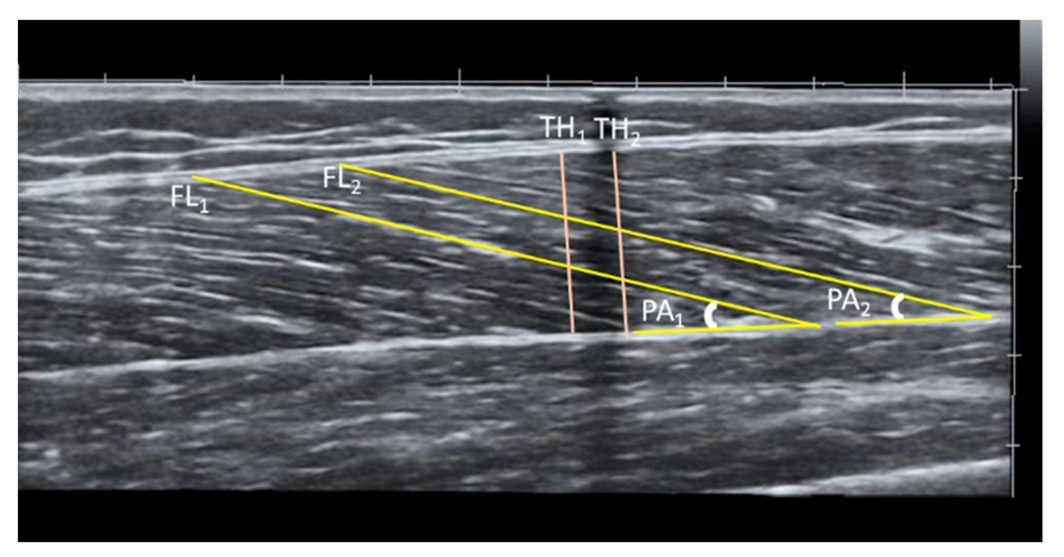 Applsci 11 05272 g002 Applsci 11 05272 g002