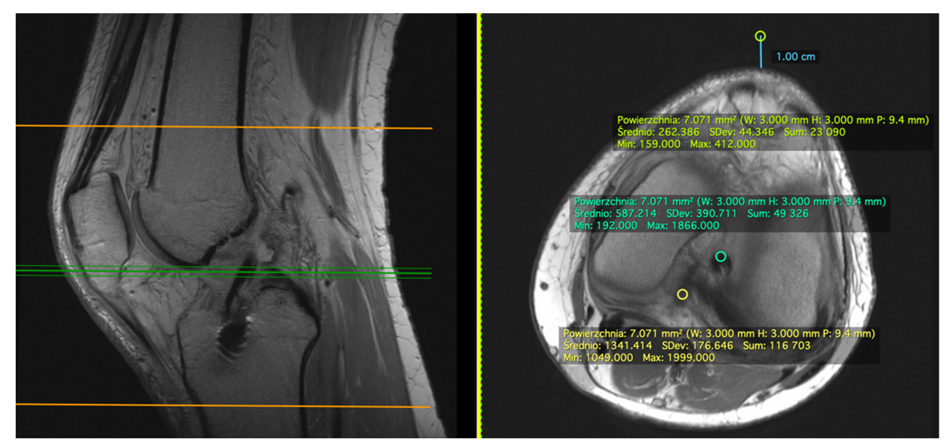 Applsci 11 05278 g002 Applsci 11 05278 g002