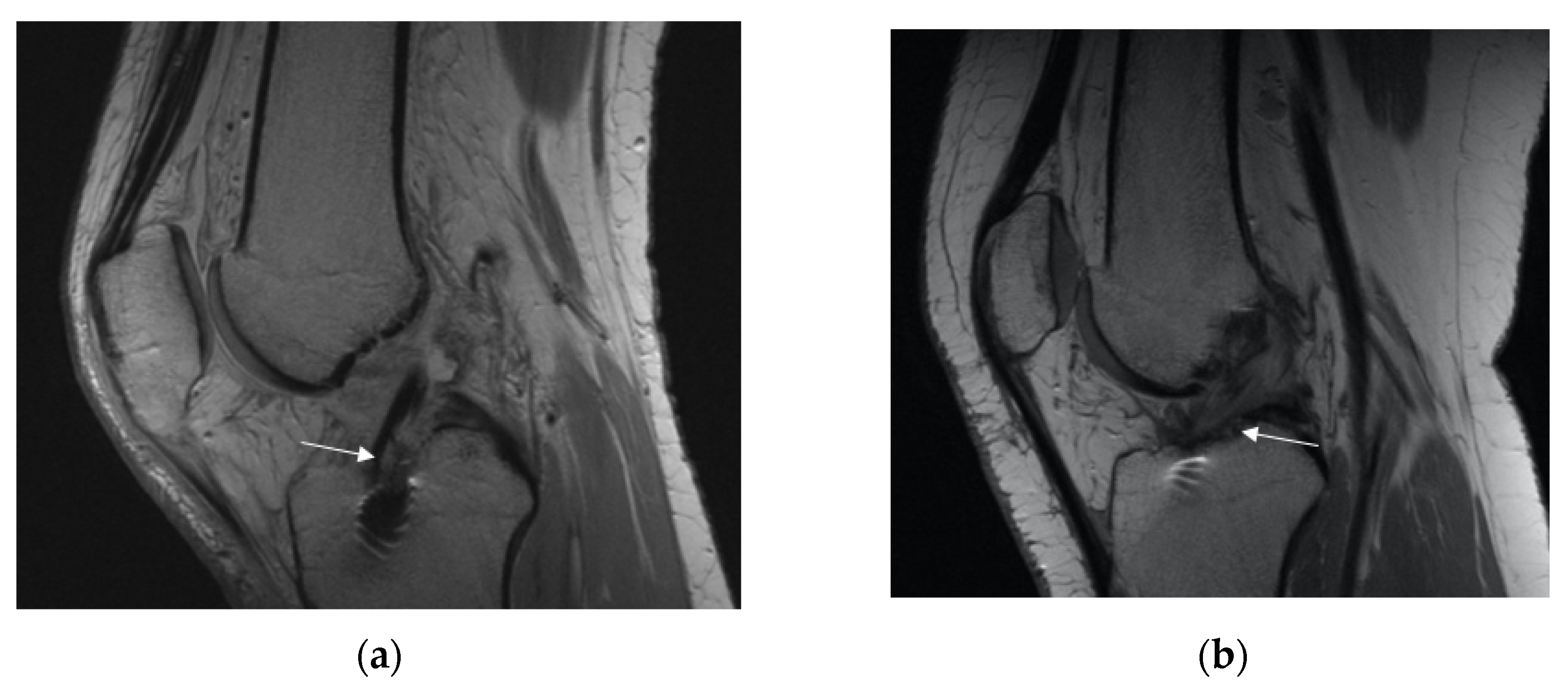 Applsci 11 05278 g003 Applsci 11 05278 g003