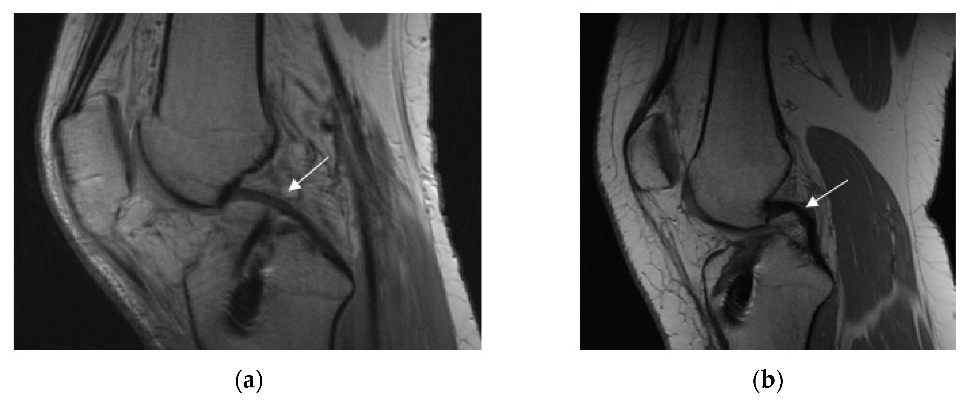 Applsci 11 05278 g004 Applsci 11 05278 g004