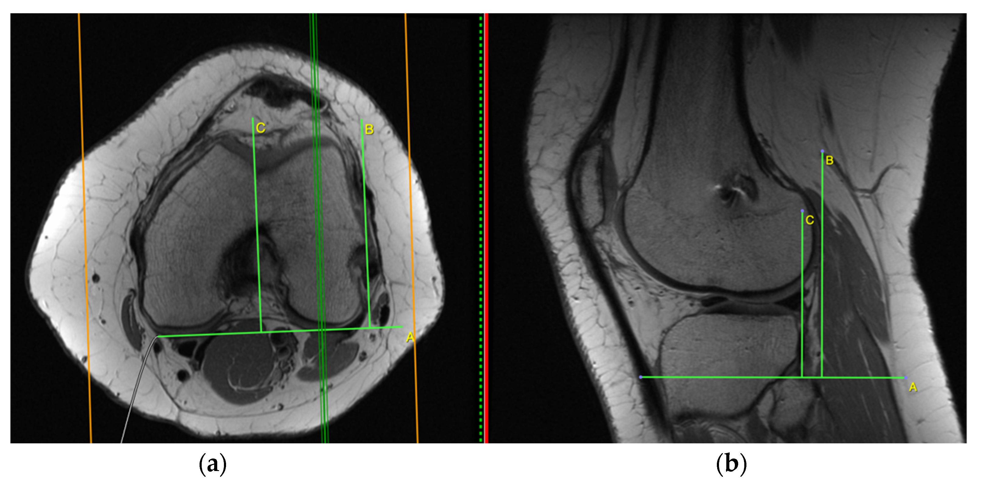 Applsci 11 05278 g005 Applsci 11 05278 g005