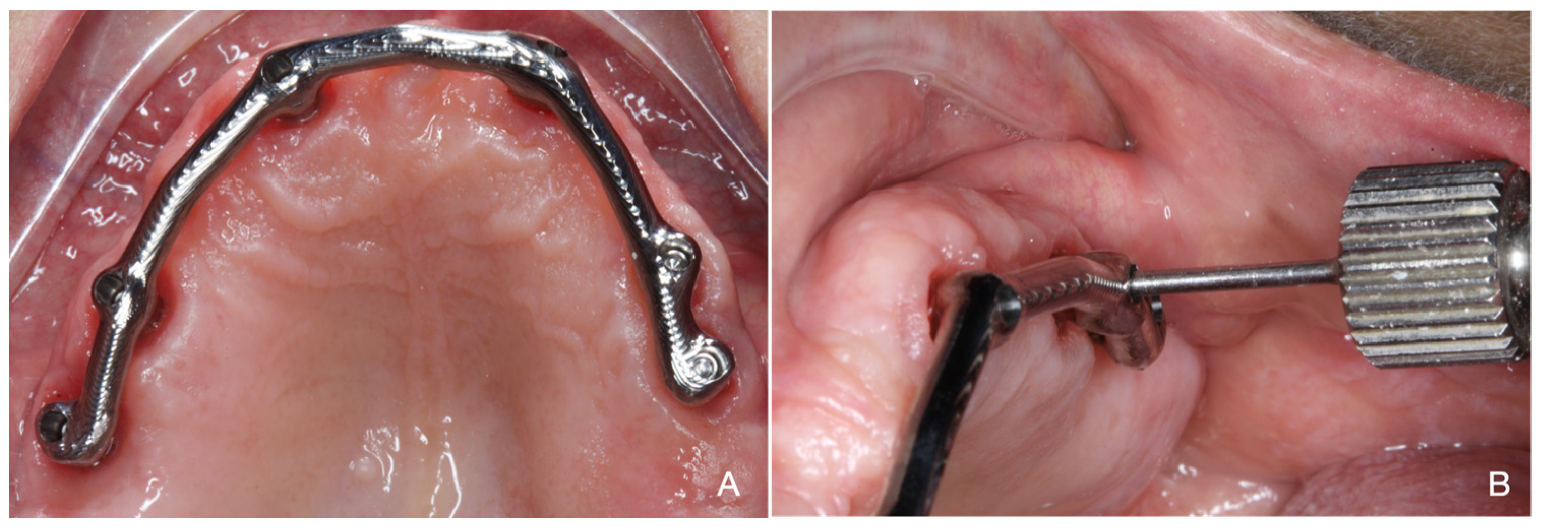 Applsci 11 05617 g004 Applsci 11 05617 g004