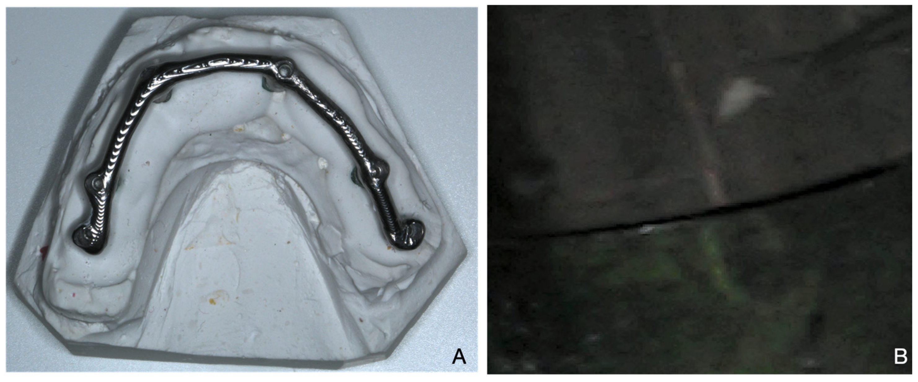 Applsci 11 05617 g005 Applsci 11 05617 g005