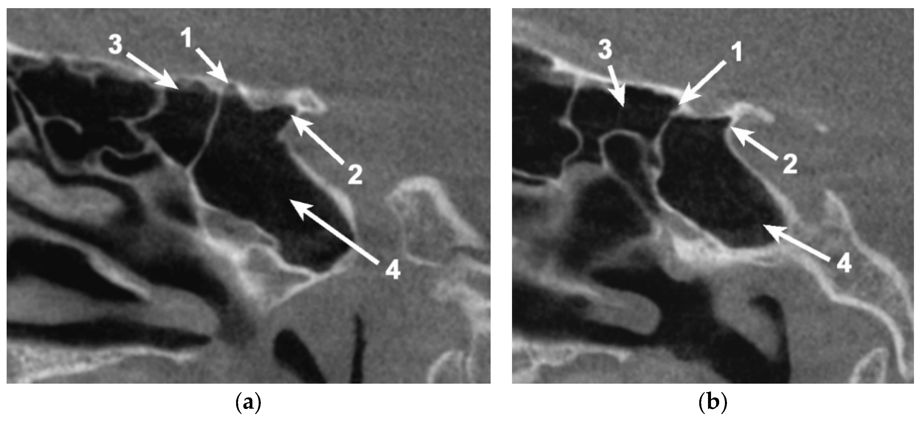 Applsci 11 05797 g003 550