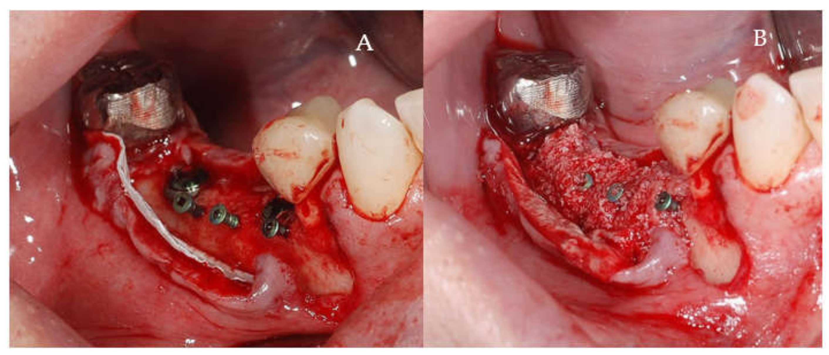 Applsci 11 06054 g004 550