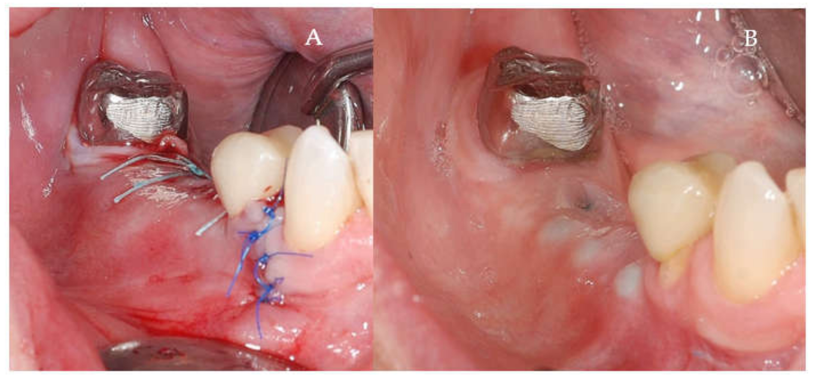 Applsci 11 06054 g005 550