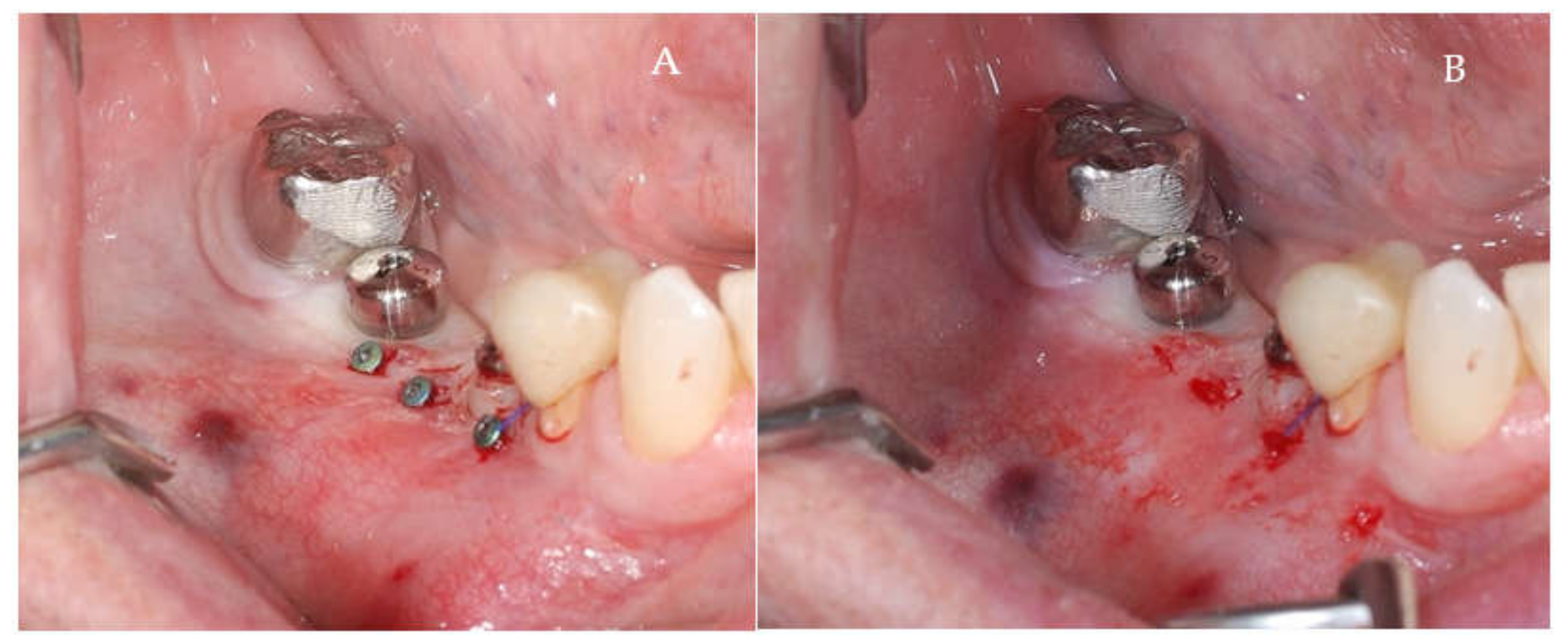 Applsci 11 06054 g008 550