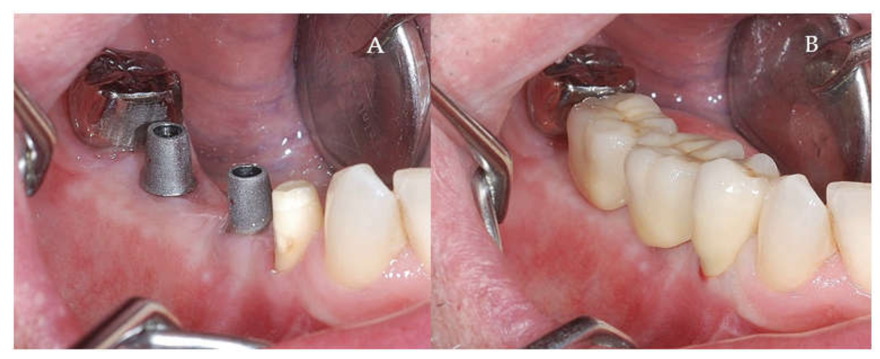 Applsci 11 06054 g010 550