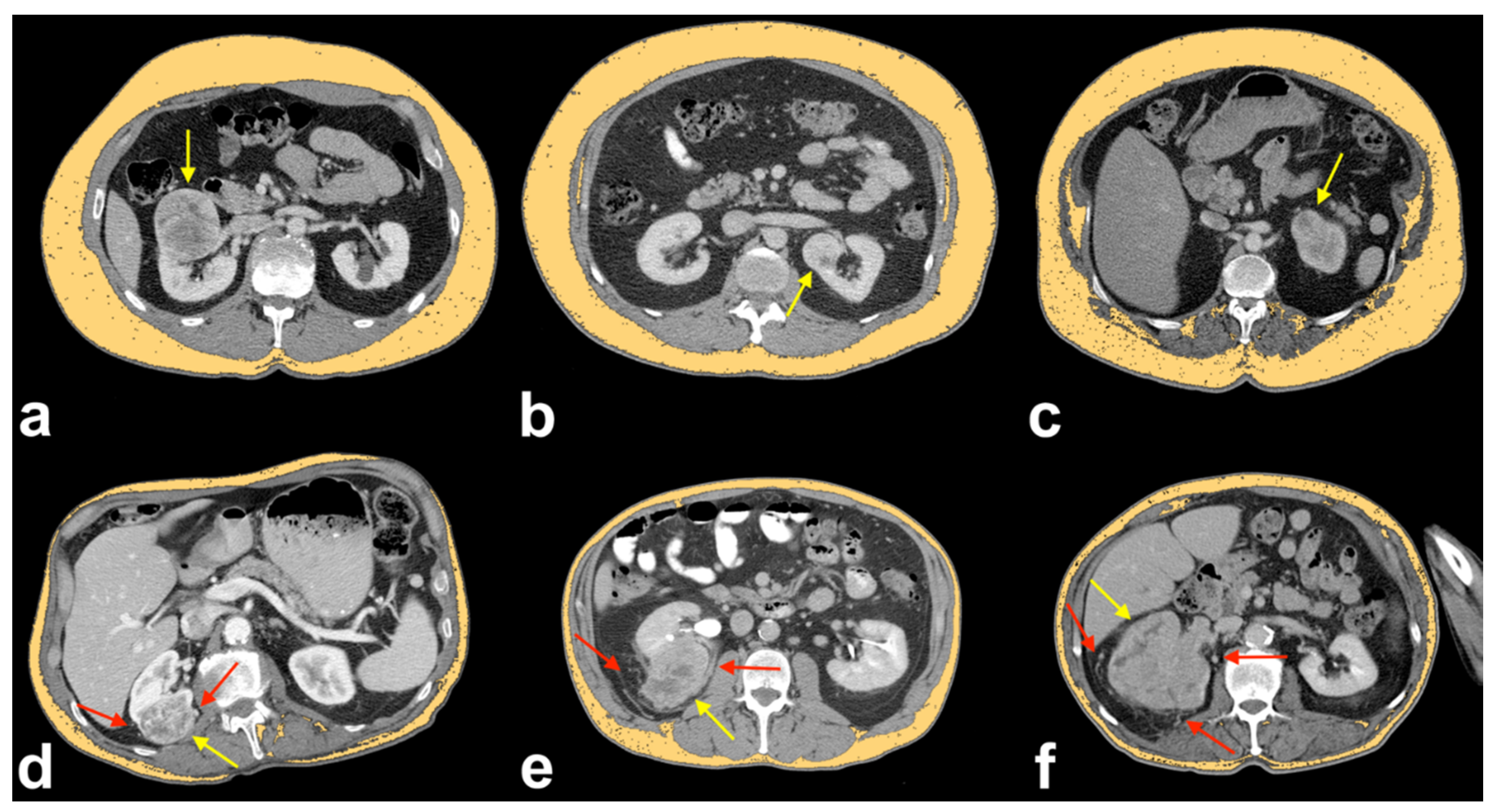 Applsci 11 06076 g004