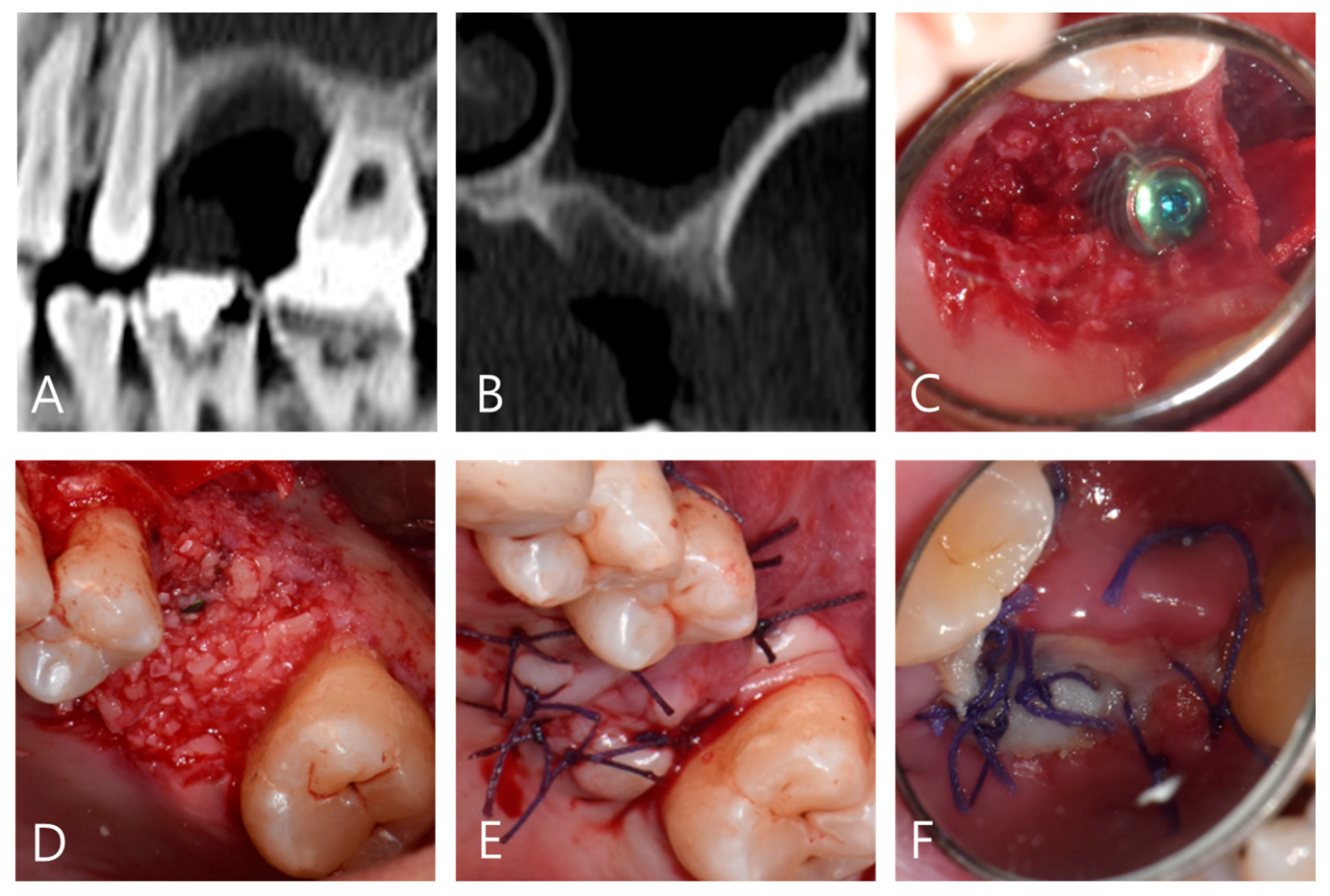 Applsci 11 06115 g002 550