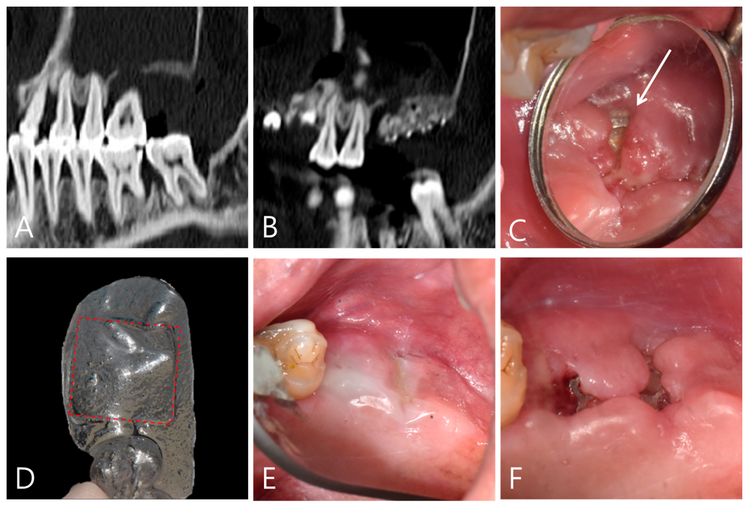 Applsci 11 06115 g004 550