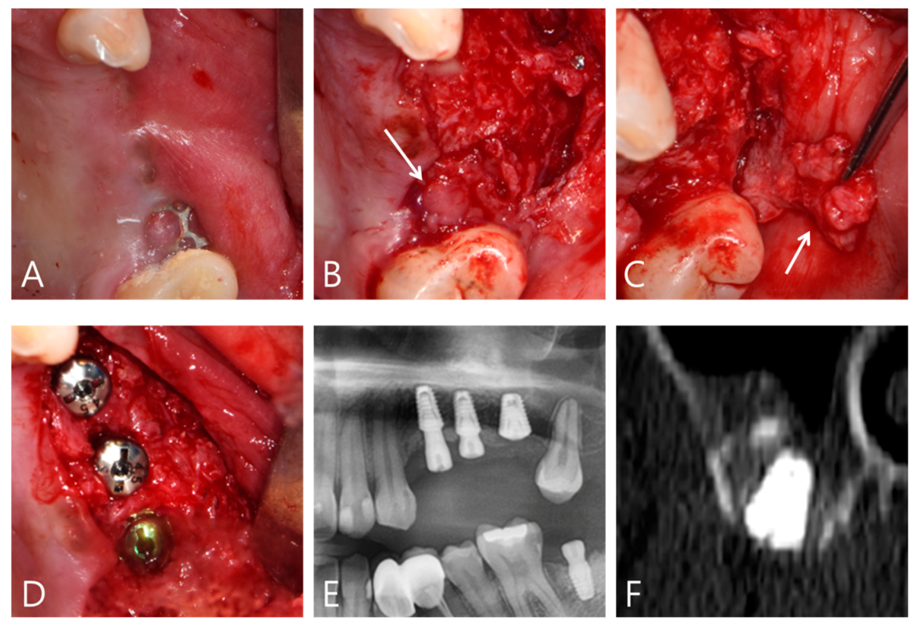 Applsci 11 06115 g007 550