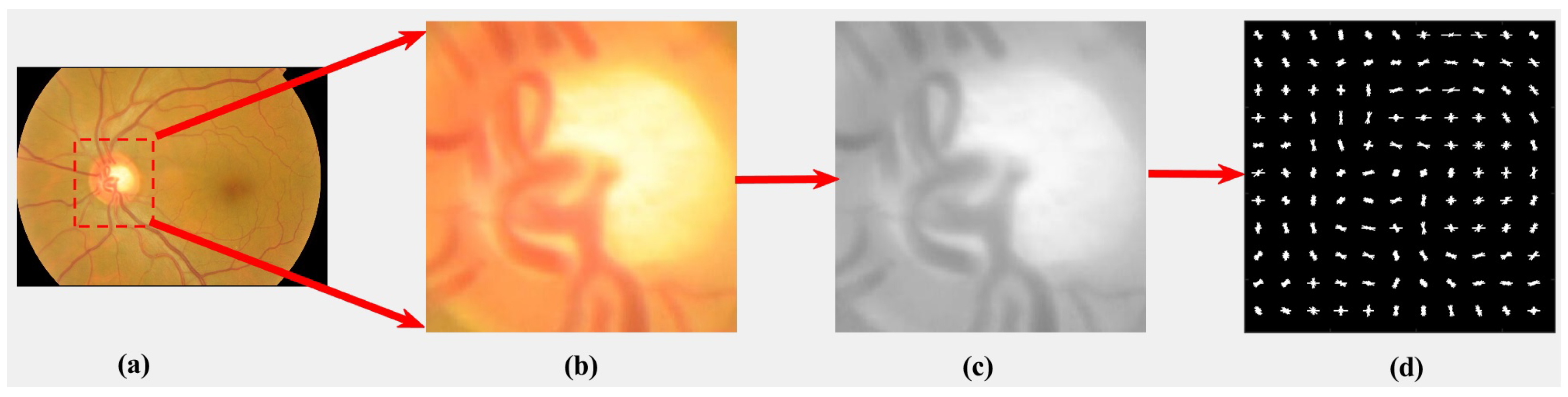 Applsci 11 06178 g005 550